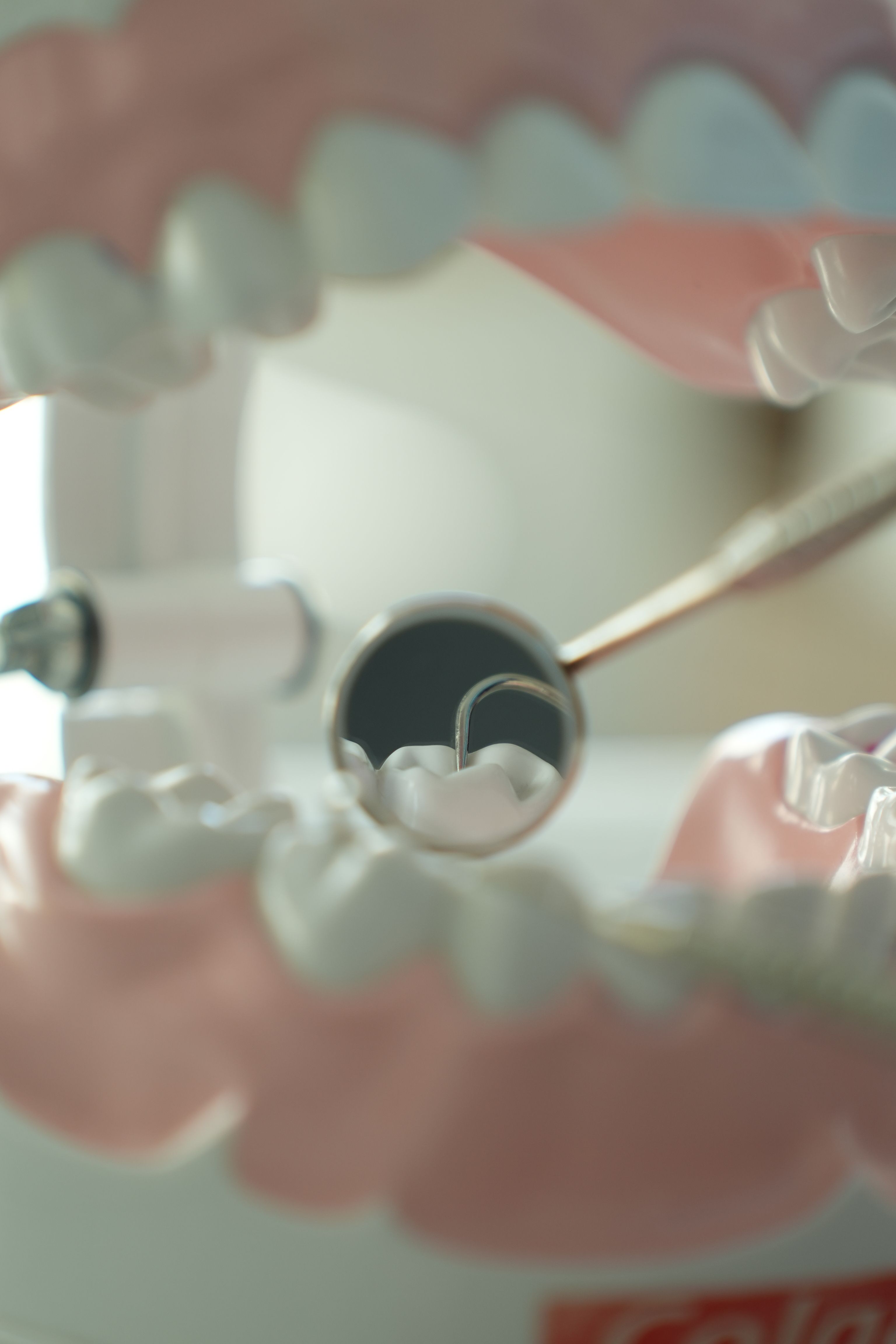Root canal treatment